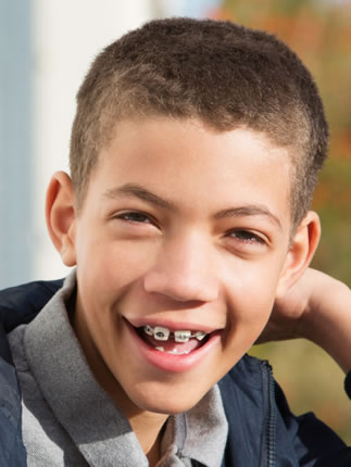metal braces