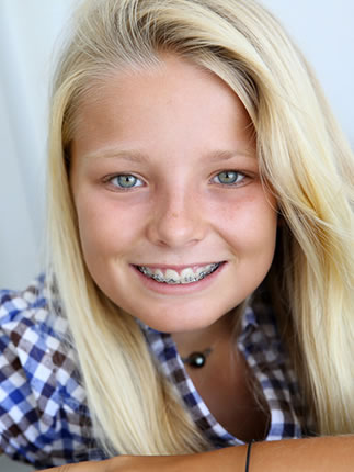 orthodontic faqs