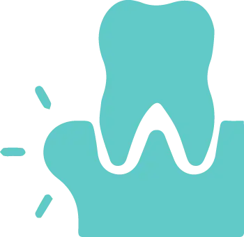 Dental Swelling