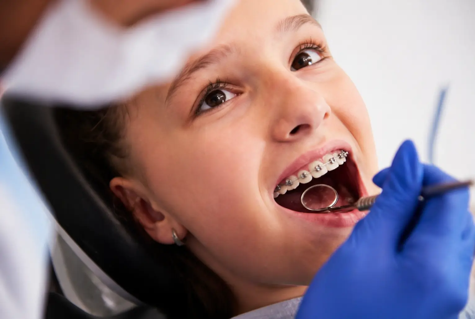Why Should I Choose Braces for Kids in Wellesley, MA