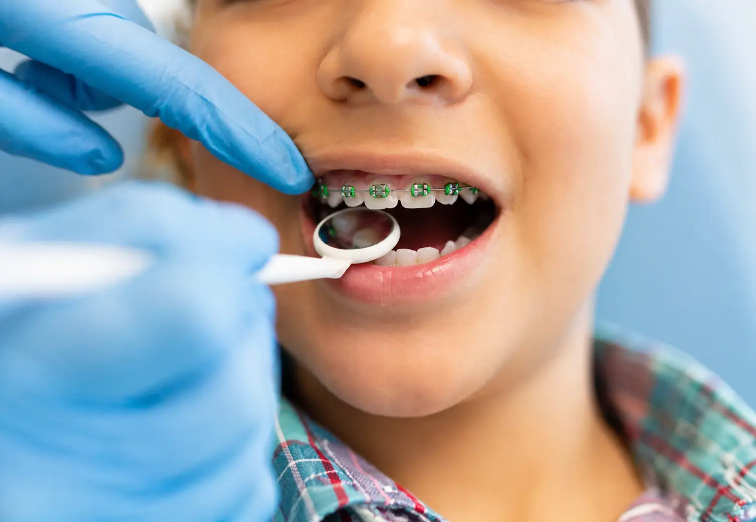Why Should I Choose Early Orthodontic Treatment 
